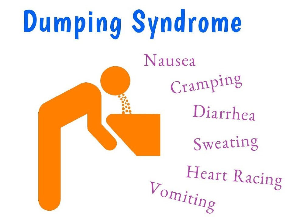 Dumping Syndrome after Bypass Surgery